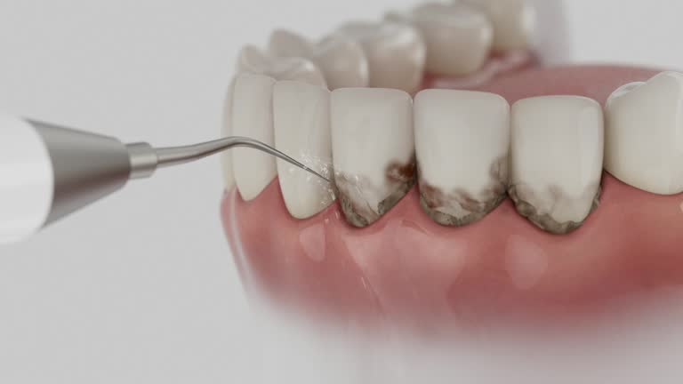 Reliable Dental contractor in Prospect, PA by Smile Center Dentistry